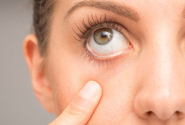 رازهایی که چشم‌ها درباره سلامت ما می‌گویند