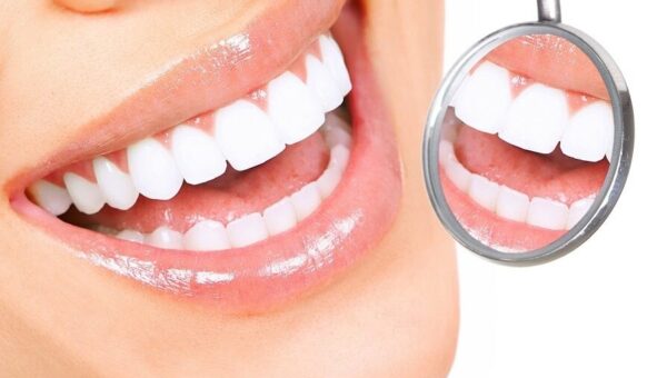  پویش سلامت دهان و دندان در سراسر کشور برگزار می شود 