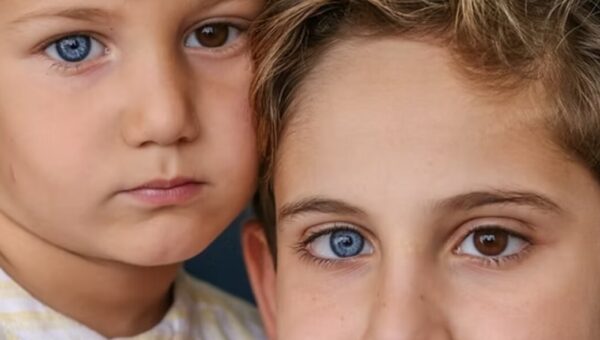 وقتی رنگ‌ چشم‌ها متفاوت است/ عکس