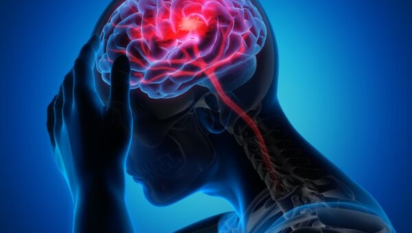 روزانه ۲۰۰ تهرانی دچار این عارضه می‌شوند