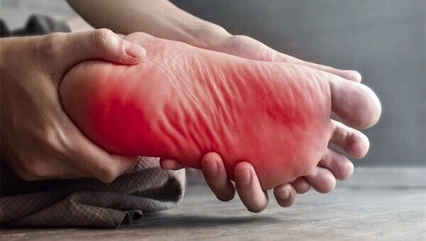 داغی کف پا نشانه چیست؟/ این علائم را جدی بگیرید