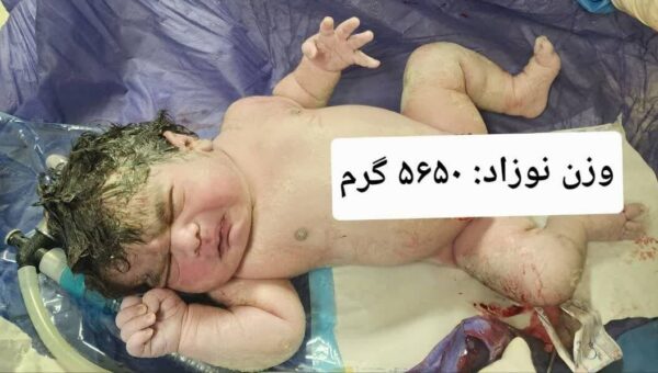 تولد نوزادی با وزن ۵ کیلو و ۶۵۰ گرم در کرمانشاه/ عکس